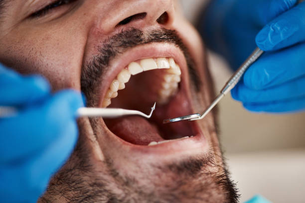Best Emergency TMJ Treatment in Churchill, OH